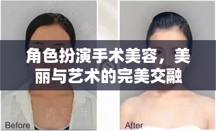 手術美容，美麗與藝術的完美交融